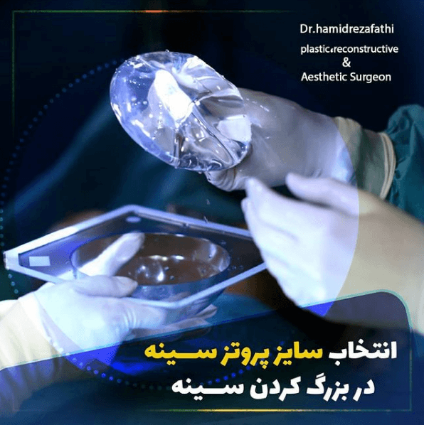 راهنمای گام به گام جراحی پروتز سینه