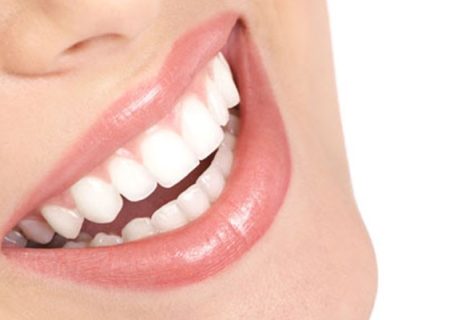 معایب لمینت دندان چیست؟