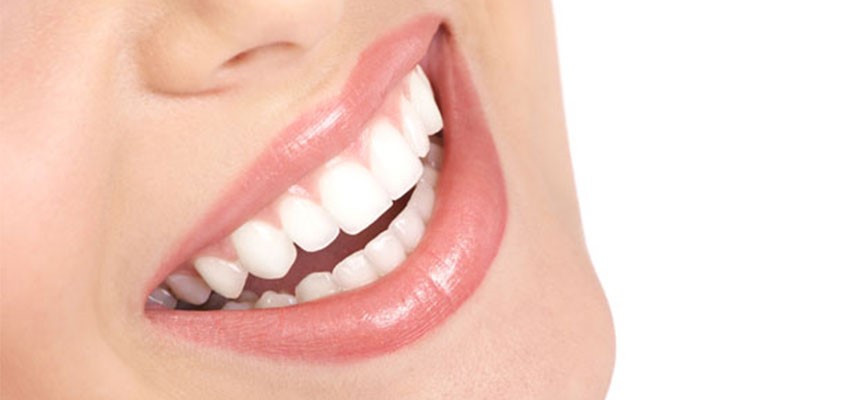 معایب لمینت دندان چیست؟