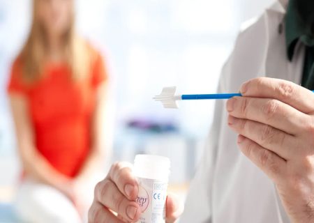 تست پاپ اسمیر برای چه خانمهایی لازم است؟