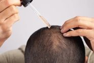 بهترین سرم ضد ریزش مو ایرانی