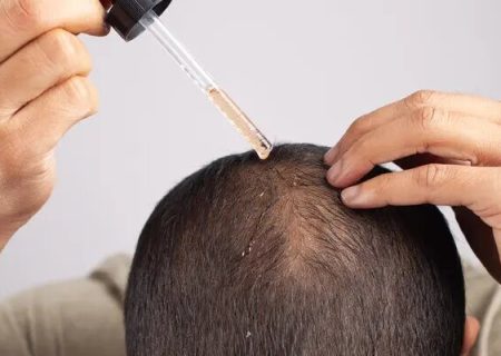 بهترین سرم ضد ریزش مو ایرانی