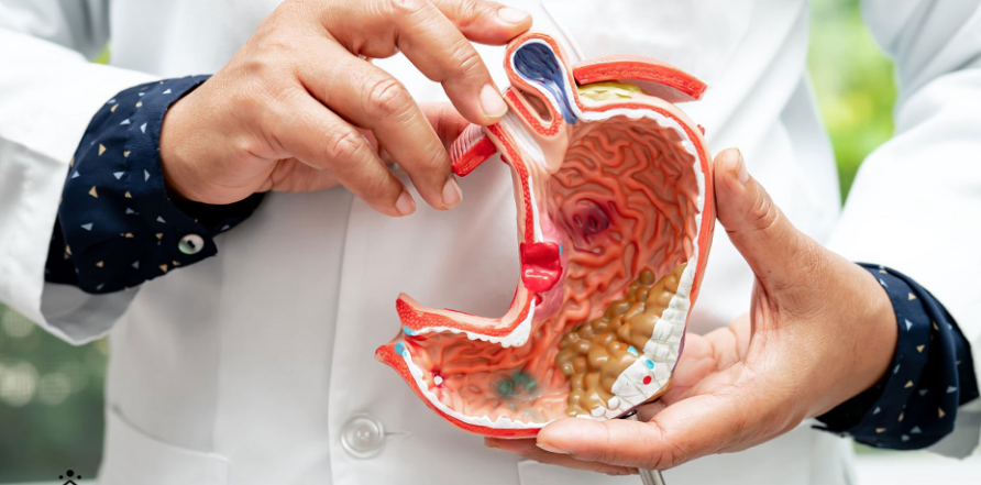 خطرات عوارض بوتاکس معده در سنین میانسالی